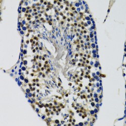 Probable ATP-Dependent RNA Helicase DDX41 (DDX41) Antibody