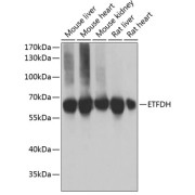 Western blot analysis of various lysates using ETFDH Antibody at 1/3000 dilution. Secondary antibody: HRP-conjugated Goat anti-Rabbit IgG (H+L) at 1/10000 dilution. Lysates / proteins: 25 µg per lane. Blocking buffer: 3 % nonfat dry milk in TBST. Detection: ECL Basic Kit (RM00020). Exposure time: 15s.