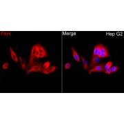 Western blot analysis of various lysates using FAH Antibody at 1/10000 dilution. Secondary antibody: HRP-conjugated Goat anti-Rabbit IgG (H+L) at 1/10000 dilution. Lysates / proteins: 25 µg per lane. Blocking buffer: 3 % nonfat dry milk in TBST. Detection: ECL Basic Kit (RM00020). Exposure time: 180s.
