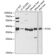 Western blot analysis of various lysates using FCN1 Antibody at 1/1000 dilution. Secondary antibody: HRP-conjugated Goat anti-Rabbit IgG (H+L) at 1/10000 dilution. Lysates/proteins: 25 µg per lane. Blocking buffer: 3% nonfat dry milk in TBST. Exposure time: 90s.