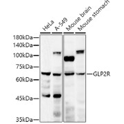 Western blot analysis of various lysates using GLP2R Antibody at 1/500 dilution. Secondary antibody: HRP-conjugated Goat anti-Rabbit IgG (H+L) at 1/10000 dilution. Lysates/proteins: 25 µg per lane. Blocking buffer: 3% nonfat dry milk in TBST. Exposure time: 180s.