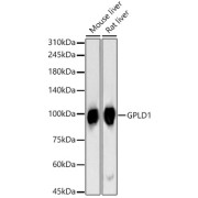 Western blot analysis of various lysates, using GPLD1 Antibody at 1/400 dilution. Secondary antibody: HRP-conjugated Goat anti-Rabbit IgG (H+L) at 1/10000 dilution. Lysates/proteins: 25 µg per lane. Blocking buffer: 3% nonfat dry milk in TBST. Exposure time: 90s.