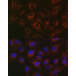 Glycosylphosphatidylinositol Specific Phospholipase D1 (GPLD1) Antibody