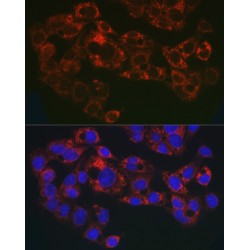 Glycosylphosphatidylinositol Specific Phospholipase D1 (GPLD1) Antibody