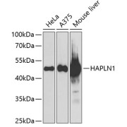 Western blot analysis of various lysates using HAPLN1 Antibody at 1/1000 dilution. Secondary antibody: HRP-conjugated Goat anti-Rabbit IgG (H+L) at 1/10000 dilution. Lysates/proteins: 25 µg per lane. Blocking buffer: 3% nonfat dry milk in TBST. Exposure time: 90s.