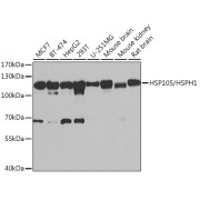 Western blot analysis of various lysates using HSP105/HSPH1 Antibody at 1/1000 dilution. Secondary antibody: HRP-conjugated Goat anti-Rabbit IgG (H+L) at 1/10000 dilution. Lysates/proteins: 25 µg per lane. Blocking buffer: 3% nonfat dry milk in TBST. Exposure time: 1s.