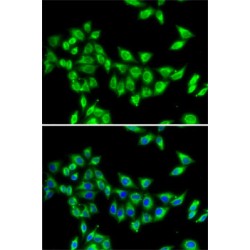 Kinesin-Like Protein KIF3A (KIF3A) Antibody