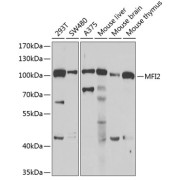 Western blot analysis of various lysates using MFI2 Antibody at 1/1000 dilution. Secondary antibody: HRP-conjugated Goat anti-Rabbit IgG (H+L) at 1/10000 dilution. Lysates/proteins: 25 µg per lane. Blocking buffer: 3% nonfat dry milk in TBST. Exposure time: 90s.