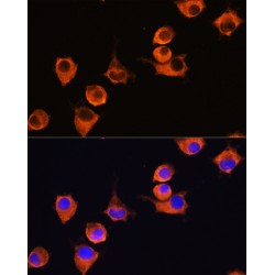 Melanotransferrin (MFI2) Antibody