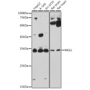 Western blot analysis of various lysates using MGLL Antibody at 1/1000 dilution. Secondary antibody: HRP-conjugated Goat anti-Rabbit IgG (H+L) at 1/10000 dilution. Lysates/proteins: 25 µg per lane. Blocking buffer: 3% nonfat dry milk in TBST. Exposure time: 180s.