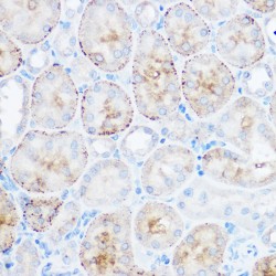 Monoglyceride Lipase (MGLL) Antibody