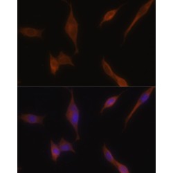 Melanophilin (MLPH) Antibody