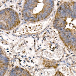 Nuclear Factor NF-Kappa-B P105 Subunit (NFKB1) Antibody