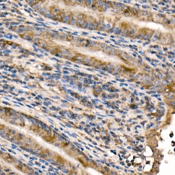 Nuclear Factor NF-Kappa-B P105 Subunit (NFKB1) Antibody