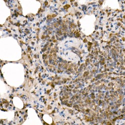 Nuclear Factor NF-Kappa-B P105 Subunit (NFKB1) Antibody