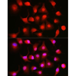 Nuclear Factor NF-Kappa-B P105 Subunit (NFKB1) Antibody