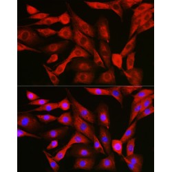 Nuclear Factor NF-Kappa-B P105 Subunit (NFKB1) Antibody