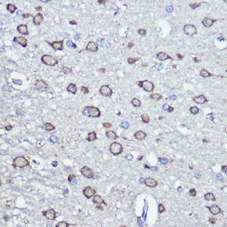 Cysteine Desulfurase, Mitochondrial (NFS1) Antibody