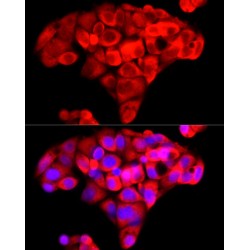 Nicotinamide N-Methyltransferase (NNMT) Antibody