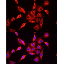 Nicotinamide N-Methyltransferase (NNMT) Antibody