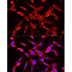 Nicotinamide N-Methyltransferase (NNMT) Antibody