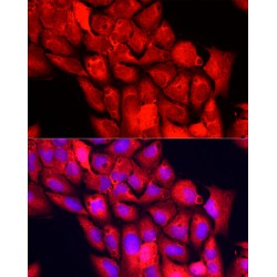 Nicotinamide N-Methyltransferase (NNMT) Antibody