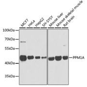 Western blot analysis of various lysates using PPM1A Antibody at 1/1000 dilution. Secondary antibody: HRP-conjugated Goat anti-Rabbit IgG (H+L) at 1/10000 dilution. Lysates/proteins: 25 µg per lane. Blocking buffer: 3% nonfat dry milk in TBST. Exposure time: 1s.