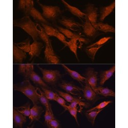 Protein Phosphatase, Mg2+/Mn2+ Dependent 1A (PPM1A) Antibody