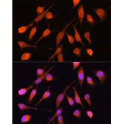 Protein Phosphatase, Mg2+/Mn2+ Dependent 1A (PPM1A) Antibody