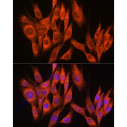 Protein Phosphatase, Mg2+/Mn2+ Dependent 1A (PPM1A) Antibody