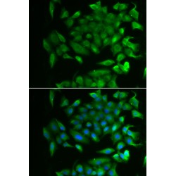 Retinol Binding Protein 2, Cellular (RBP2) Antibody