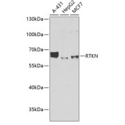 Western blot analysis of various lysates using RTKN Antibody at 1/1000 dilution. Secondary antibody: HRP-conjugated Goat anti-Rabbit IgG (H+L) at 1/10000 dilution. Lysates/proteins: 25 µg per lane. Blocking buffer: 3% nonfat dry milk in TBST. Exposure time: 1s.