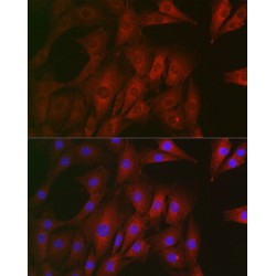 Rhotekin (RTKN) Antibody