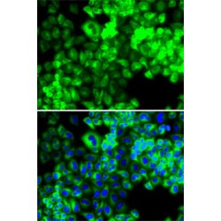Serine--tRNA Ligase, Cytoplasmic (SARS1) Antibody