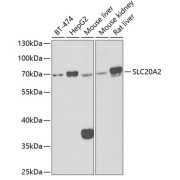 Western blot analysis of various lysates using SLC20A2 Antibody at 1/1000 dilution. Secondary antibody: HRP-conjugated Goat anti-Rabbit IgG (H+L) at 1/10000 dilution. Lysates/proteins: 25 µg per lane. Blocking buffer: 3% nonfat dry milk in TBST. Exposure time: 90s.