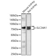 Western blot analysis of various lysates, using SLC34A1 Antibody at 1/800 dilution. Secondary antibody: HRP-conjugated Goat anti-Rabbit IgG (H+L) at 1/10000 dilution. Lysates/proteins: 25 µg per lane. Blocking buffer: 3% nonfat dry milk in TBST. Exposure time: 90s.