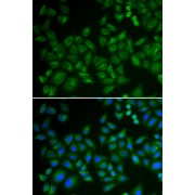 Western blot analysis of various lysates using SMPD1 / ASM Antibody at 1/1000 dilution. Secondary antibody: HRP-conjugated Goat anti-Rabbit IgG (H+L) at 1/10000 dilution. Lysates / proteins: 25 µg per lane. Blocking buffer: 3 % nonfat dry milk in TBST. Detection: ECL Basic Kit (RM00020). Exposure time: 5s.