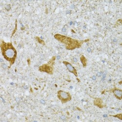 ST3 Beta-Galactoside Alpha-2,3-Sialyltransferase 3 (ST3GAL3) Antibody