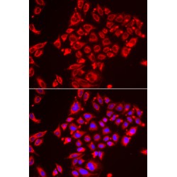 ST3 Beta-Galactoside Alpha-2,3-Sialyltransferase 3 (ST3GAL3) Antibody