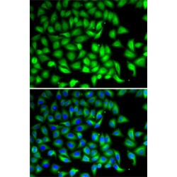 SUFU Negative Regulator of Hedgehog Signaling (SUFU) Antibody