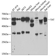 Western blot analysis of various lysates using TAT Antibody at 1/1000 dilution. Secondary antibody: HRP-conjugated Goat anti-Rabbit IgG (H+L) at 1/10000 dilution. Lysates/proteins: 25 µg per lane. Blocking buffer: 3% nonfat dry milk in TBST. Exposure time: 5min.