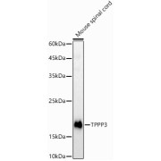 Western blot analysis of lysates from Mouse spinal cord, using TPPP3 Antibody at 1/1000 dilution. Secondary antibody: HRP-conjugated Goat anti-Rabbit IgG (H+L) at 1/10000 dilution. Lysates/proteins: 25 µg per lane. Blocking buffer: 3% nonfat dry milk in TBST. Exposure time: 90s.