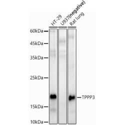 Tubulin Polymerization-Promoting Protein Family Member 3 (TPPP3) Antibody