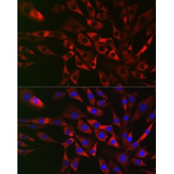 TRAF3 Interacting Protein 2 (TRAF3IP2) Antibody