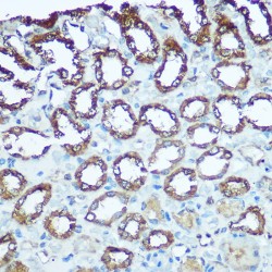 Ubiquinol-Cytochrome C Reductase, Rieske Iron-Sulfur Polypeptide 1 (UQCRFS1) Antibody