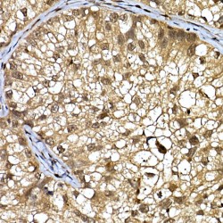 DDB1 And CUL4 Associated Factor 7 (DCAF7) Antibody