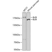 Western blot analysis of various lysates using Bcl9 Antibody at 1/400 dilution. Secondary antibody: HRP-conjugated Goat anti-Rabbit IgG (H+L) at 1/10000 dilution. Lysates/proteins: 25 µg per lane. Blocking buffer: 3% nonfat dry milk in TBST. Exposure time: 30s.