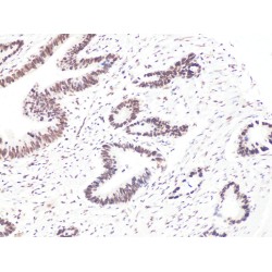 B-Cell CLL/Lymphoma 9 (BCL9) Antibody