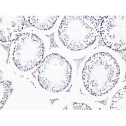 B-Cell CLL/Lymphoma 9 (BCL9) Antibody
