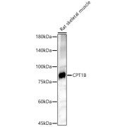 Western blot analysis of lysates from Rat skeletal muscle, using CPT1B Antibody at 1/500 dilution. Secondary antibody: HRP-conjugated Goat anti-Rabbit IgG (H+L) at 1/10000 dilution. Lysates/proteins: 25 µg per lane. Blocking buffer: 3% nonfat dry milk in TBST. Exposure time: 180s.